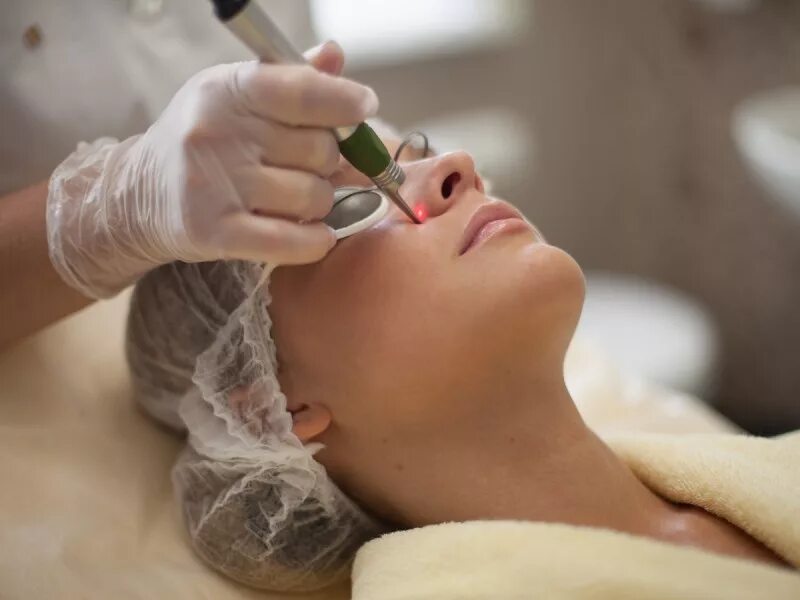 лазерная коагуляция сосудов. диодный лазер 980 для удаления сосудов. Skin неодимовый лазер (лазерный аппарат. лазер неодимов сосуд удаление. лазерная фотокоагуляция сосудов.