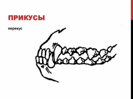 Схемы прикусов