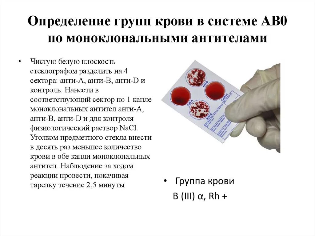 Аво антитела