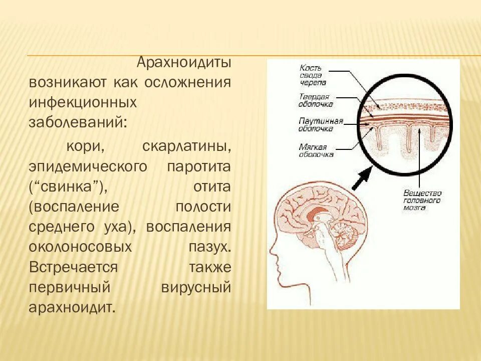 Менингит головного мозга. Воспаление паутинной мозговой оболочки. Менингит воспаление оболочек головного мозга. Воспаление мозговых оболочек симптомы у ребенка. Воспаление головных оболочек.