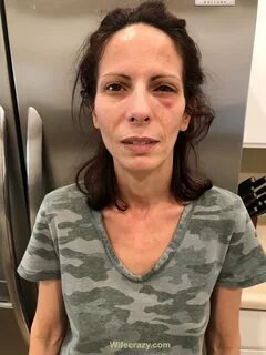 Stacie on Twitter: "👁 doing much better today 😉 #crazyeye https://t....