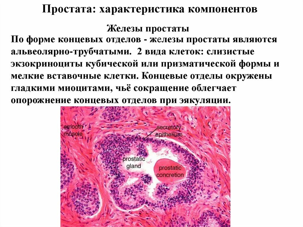 Предстательная железа гистология. Гистологическое строение предстательной железы. Клетки концевых отделов простаты. Гипертрофия предстательной железы гистология. Предстательная железа включения