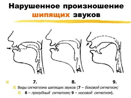 Произношение звуков изучает