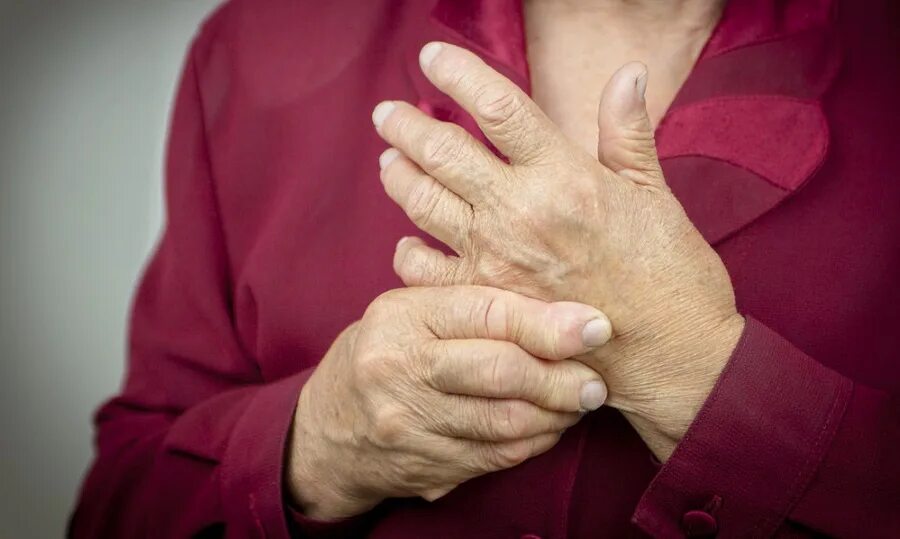Ревматоидный артрит полиартрит. Полиартроз суставов ног. Полиартрит врач. Полиартрит врач. Заболевание суставов у пожилых людей.