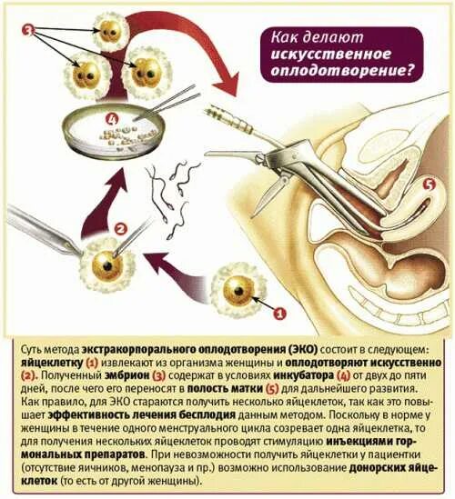 Как происходит искусственное оплодотворение