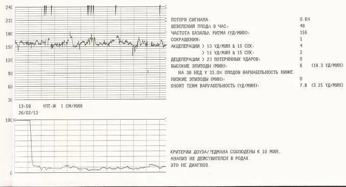 КТГ плода норма 38 неделе беременности. КТГ плода норма 37 недель беременности. КТГ при беременности расшифровка 38. КТГ при беременности 37 недель показатели. 38 неделя мало шевелится