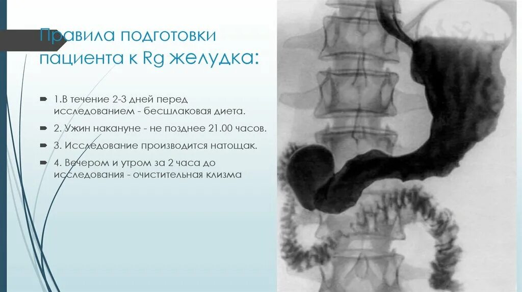 Фгдс желудка за сколько часов нельзя есть. Ирригография подготовка пациента. показания к проведению ирригоскопии:. ирригоскопия желудка подготовка пациента.