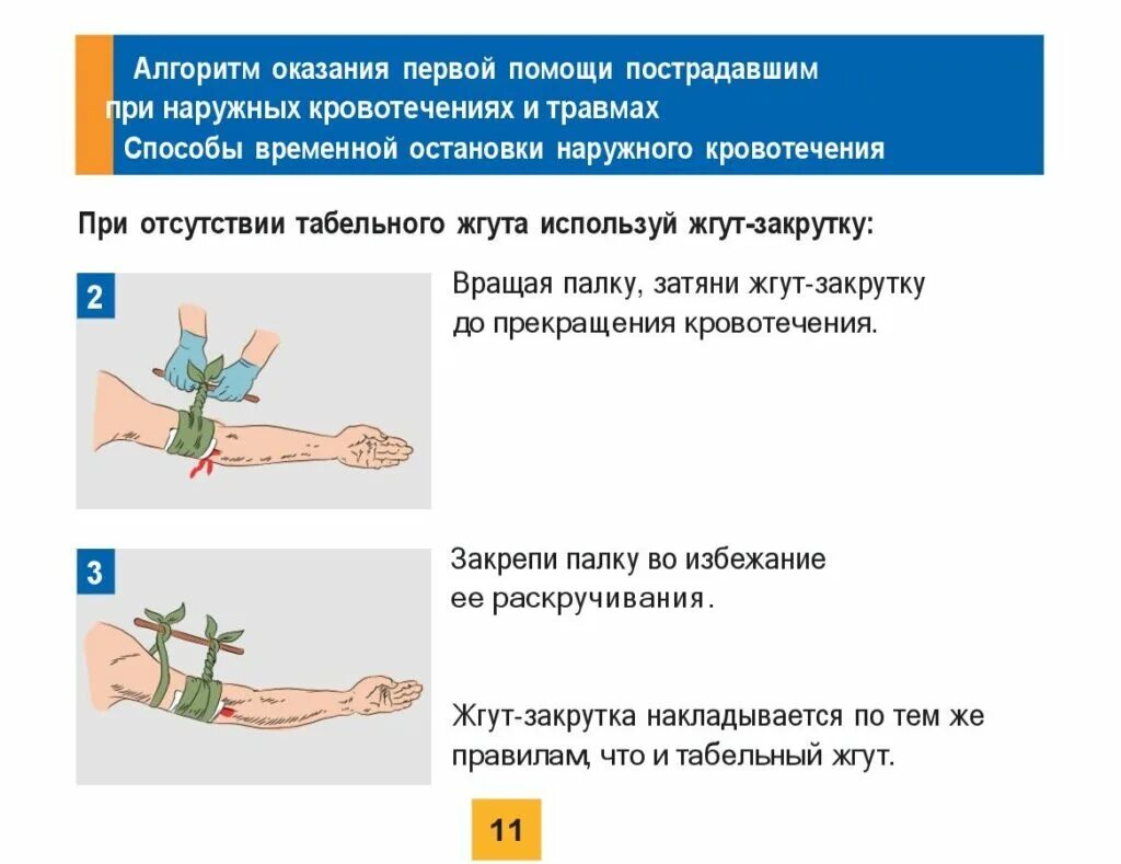 Пострадавшему с сильным наружным кровотечением. Остановка кровотечения наложение жгута закрутки. Наложение артериального жгута закрутки. Жгут используется для остановки венозного кровотечения.. Наложение жгута закрутки на верхнюю конечность.