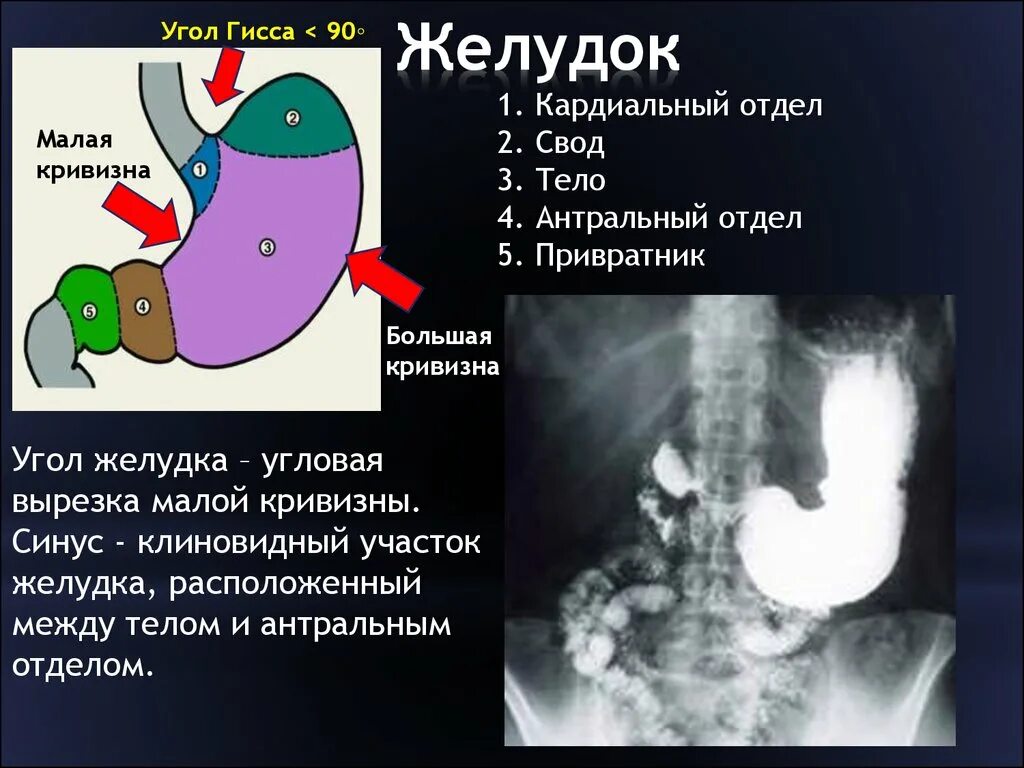 Кардиальный латынь. Антральный отдел и пилорический отдел желудка. Патология ЖКТ лучевая диагностика. Строение желудка антральный отдел. Рентгенодиагностика заболеваний ЖКТ.