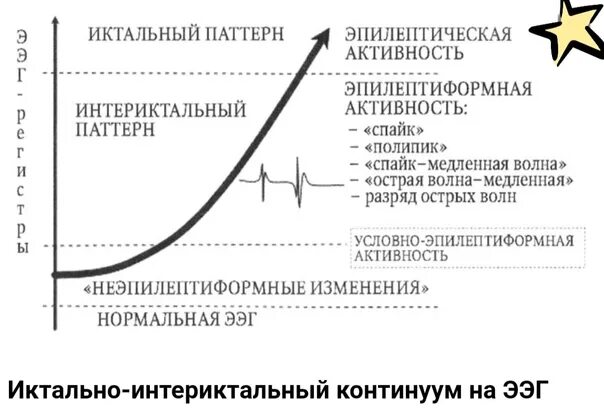 Что значит эпилептиформная активность. Интериктальная эпилептиформная активность. Иктальный паттерн на ЭЭГ при эпилепсии. Эпилептиформные паттерны. Региональная эпилептиформная активность ЭЭГ.