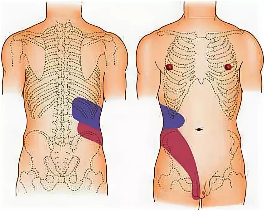 Поясница отдает в пах у мужчин. Иррадиация боли при почечной колике. Почечная колика иррадиация болей. Острая почечная колика локализация боли. Почечная колика болевая зона.