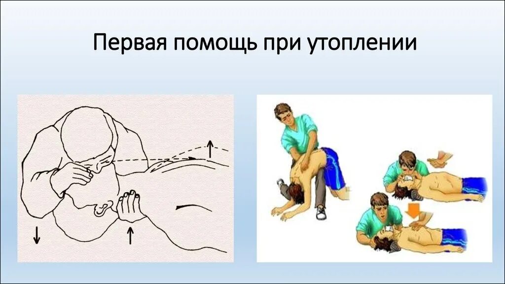 Последовательность оказания помощи при утоплении. Оказание пп при утоплении. оказание первой помощи при утоплении. первая помощь утопающему. оказание первой мед помощи при утоплении.
