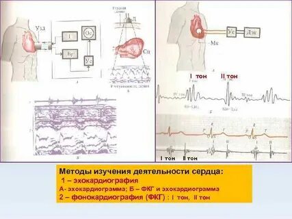 Электрокардиография один из важных