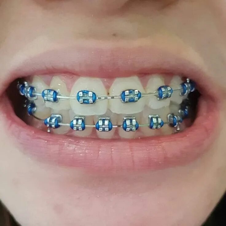 Matching brackets