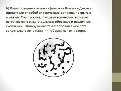 В мокроте обнаружили