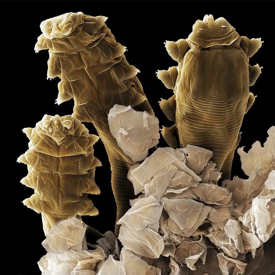 Железница угревая Demodex folliculorum