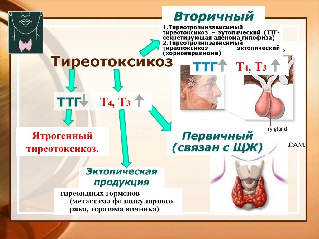 Гипертиреоз первичный и вторичный. Первичный тиреотоксикоз. Тиреотоксикоз ТТГ. ТТГ- секретирующая опухоль гипофиза. Пролактин щитовидная