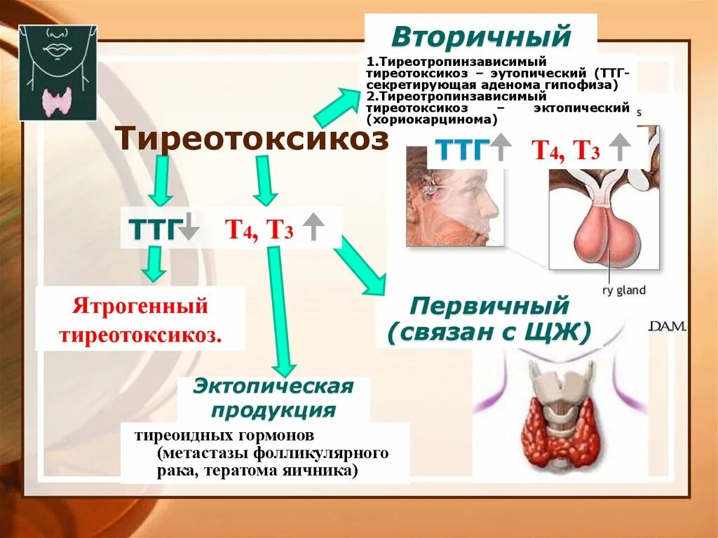 Гипертиреоз первичный и вторичный. Первичный тиреотоксикоз. Тиреотоксикоз ТТГ. ТТГ- секретирующая опухоль гипофиза. Тиреотропный гормон гипофиза