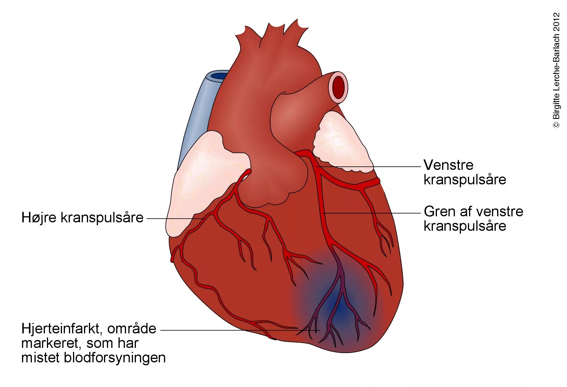 14 февраля приколы. Сердце подобных. Кардиомиопатия сердца что это такое. Сердце подобных. Сердце подобных.