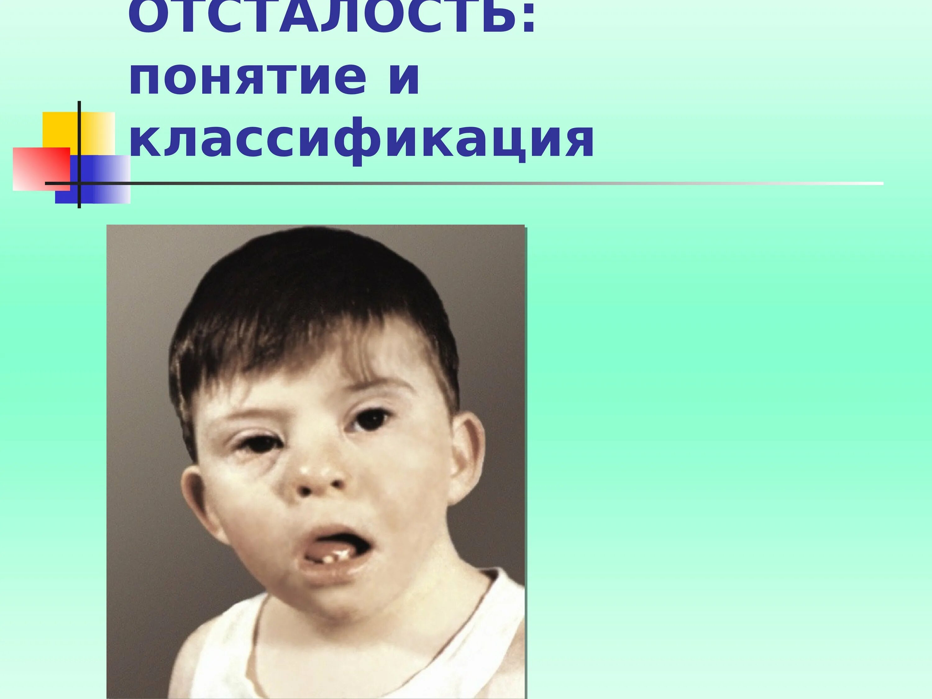 Наследственной умственной отсталости. Умственная отсталость. Внешние проявления олигофрении. Умственно отсталые дети. Умственная отсталость олигофрения.