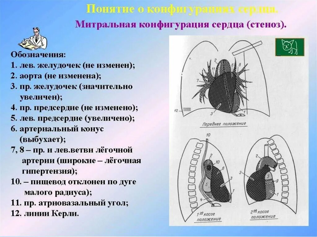 Конфигурации сердца. Конфигурация сердца при митральной недостаточности. митральная конфигурация сердца рентген. митральная конфигурация сердца форма. митральная и аортальная конфигурация.