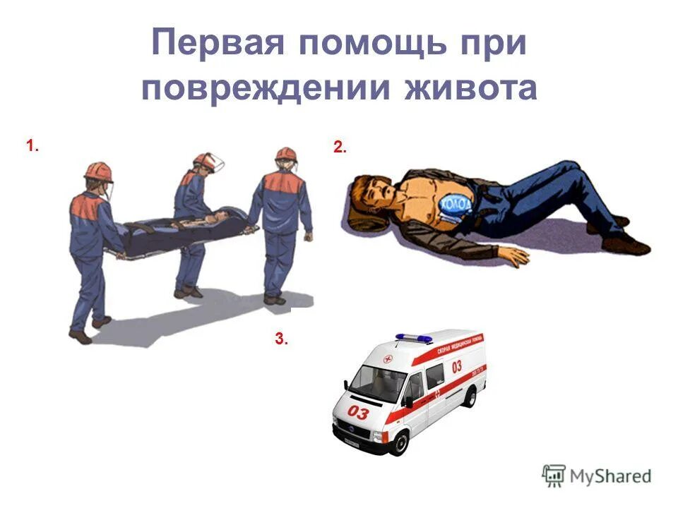 первая помощь пострадавшему при травмы живота.