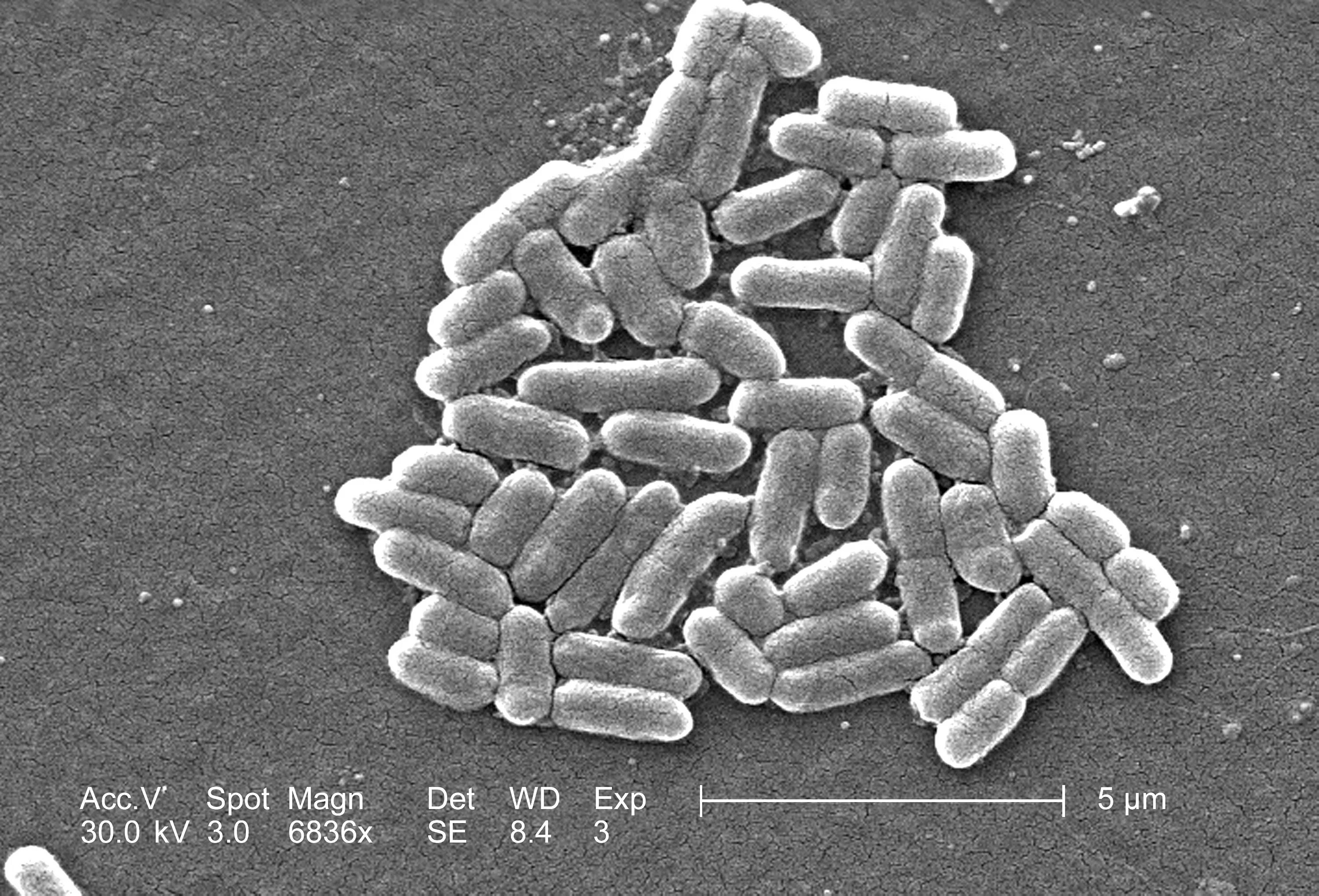 Болезнетворная бактерия палочка. Кишечная палочка Escherichia coli. Кишечная палочка Еscherichia coli. Escherichia coli эшерихии. Кишечная палочка о114.