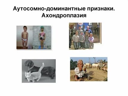 Полидактилия доминантный аутосомный