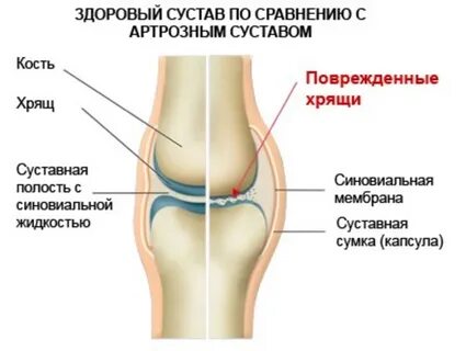 Почему женщины кости хрустят кости