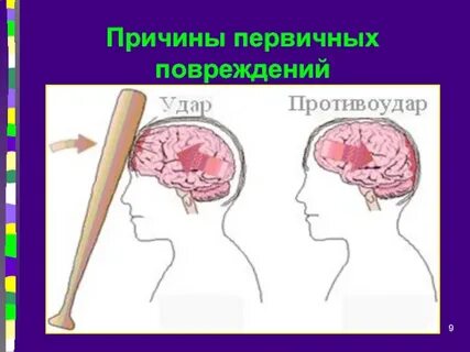 Причины ранений