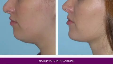 Щек 1