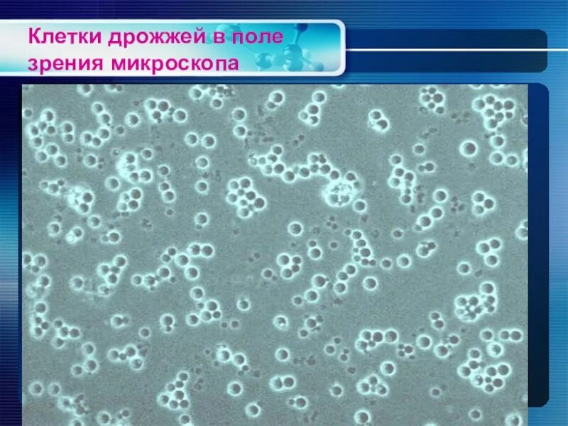 Оборудование для изучения клеток дрожжевых грибов. Дрожжей Saccharomyces cerevisiae микроскопия. Пекарские дрожжи под микроскопом. Дрожжевая клетка микроскоп. Дрожжевые клетки в моче под микроскопом.