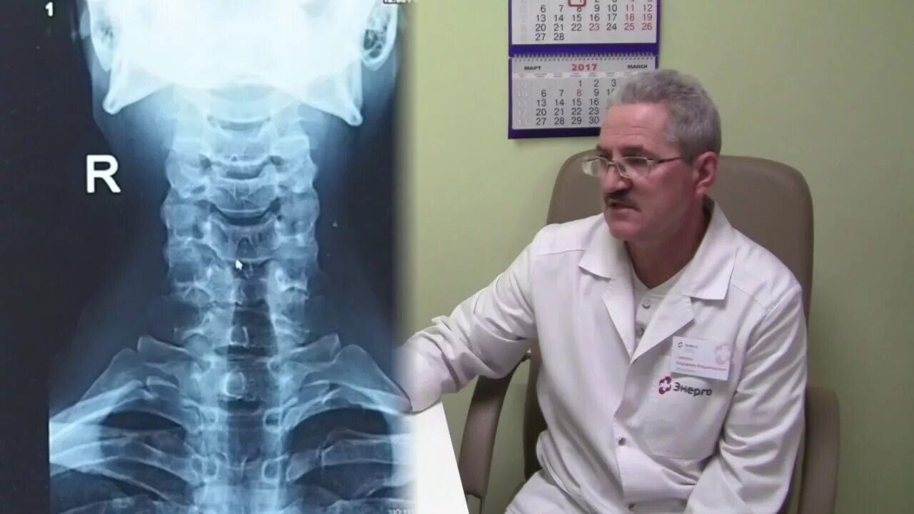 Рентген шейного отдела сбоку. Как делают рентген шейного отдела позвоночника. Как делают рентген шейного отдела позвоночника. Рентген шейных позвонков. Рентгенологическое исследование.