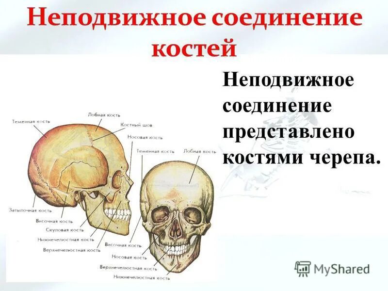 выберите неподвижные соединения костей