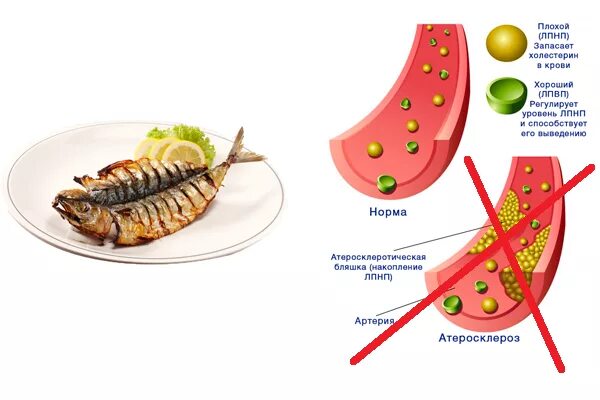 Какая рыба полезна для беременных. Какую рыбу полезно кушать беременным. Какую рыбу можно при холестерине