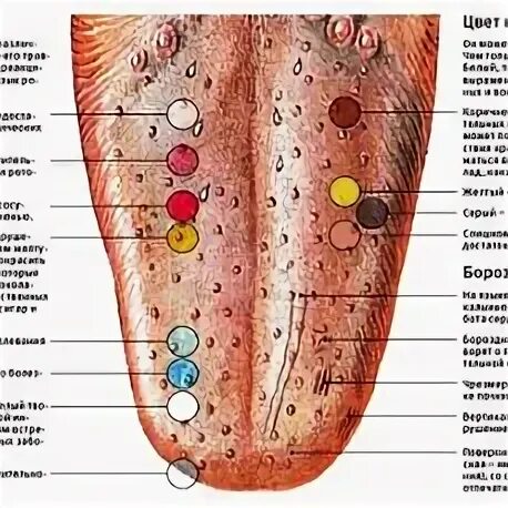 Язык точек. Красные прыщи на кончике языка. Язык точек. Язык точек. Склерозирующий глоссит.