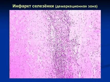 Демаркационная линия