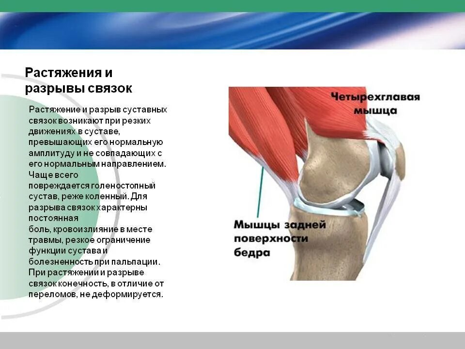 Боль коленной связки. Растяжение латеральной связки колена симптомы. Растяжение связок коленного сустава клиника. Растяжение связочного аппарата левого коленного сустава. Растяжение связок (коленный сустав); алгоритм.