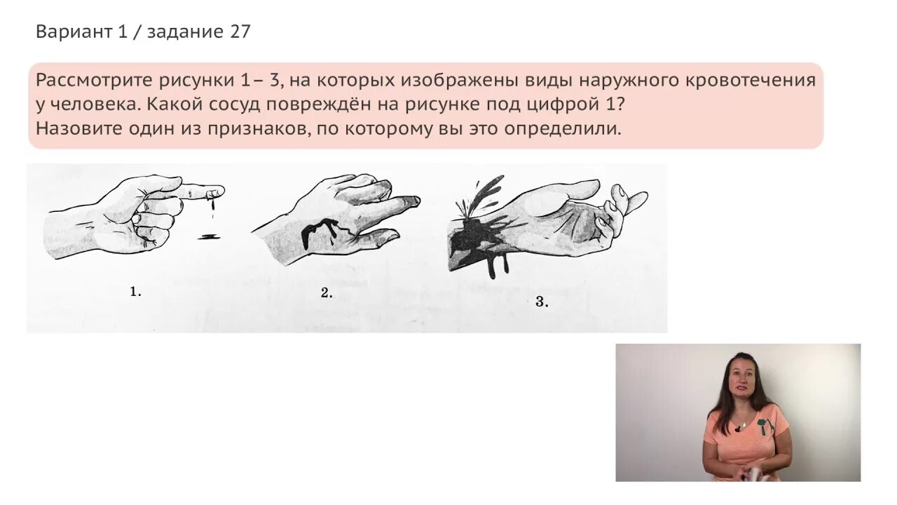 Какой сосуд поврежден. Виды кровотечений ОГЭ биология. Повышенная кровоточивость ОГЭ.