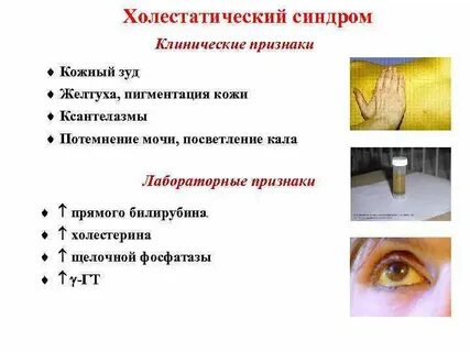 Синдром кожного зуда