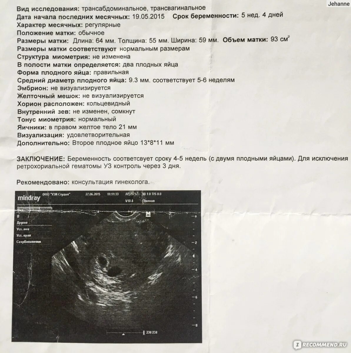 Плодное яйцо на 6 неделе беременности УЗИ. Плодное яйцо при беременности 5 6 недель. Плодное яйцо 2 недели срок по УЗИ. Как выглядит эмбрион в 5 недель на УЗИ.