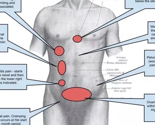 Болит над животом посередине причины у женщин. Локализация боли в животе. Болит живот справа. Болит низ живота. Резь в левой стороне живота.
