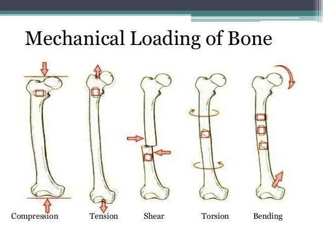 Изгиб кости. Кости изгиб физика. External Forces Reaction tension stretching, rupture Compression Torsion bending Shear. Изгибы костей