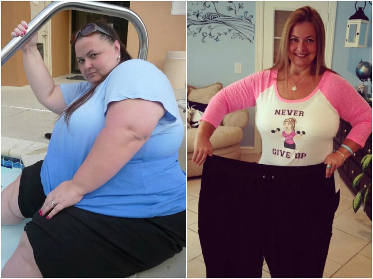 Сильно большой вес. Похудение до и после. До и после похудения девушки.