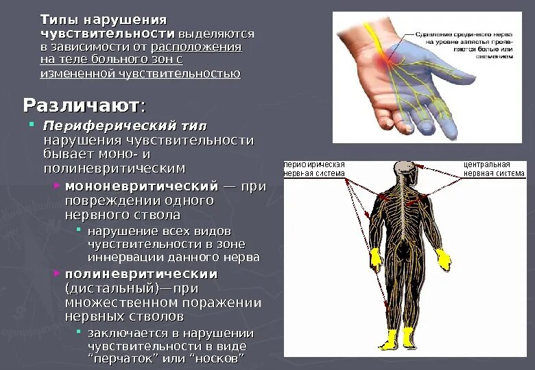 Периферический мононевритический Тип нарушения чувствительности. Полиневритический Тип нарушения чувствительности неврология. Проводниковый Тип нарушения чувствительности. Периферический Тип нарушения. Типы поражения нервов