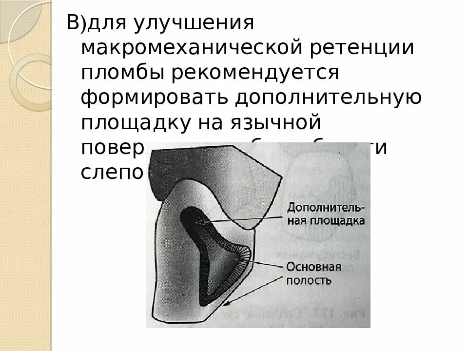 Iv класс блэка. Препарирование по 4 классу блэка. препарирование кариозных полостей 4 класса. препарирование полостей 4 класса по блэку. полость 4 класса по блэку.