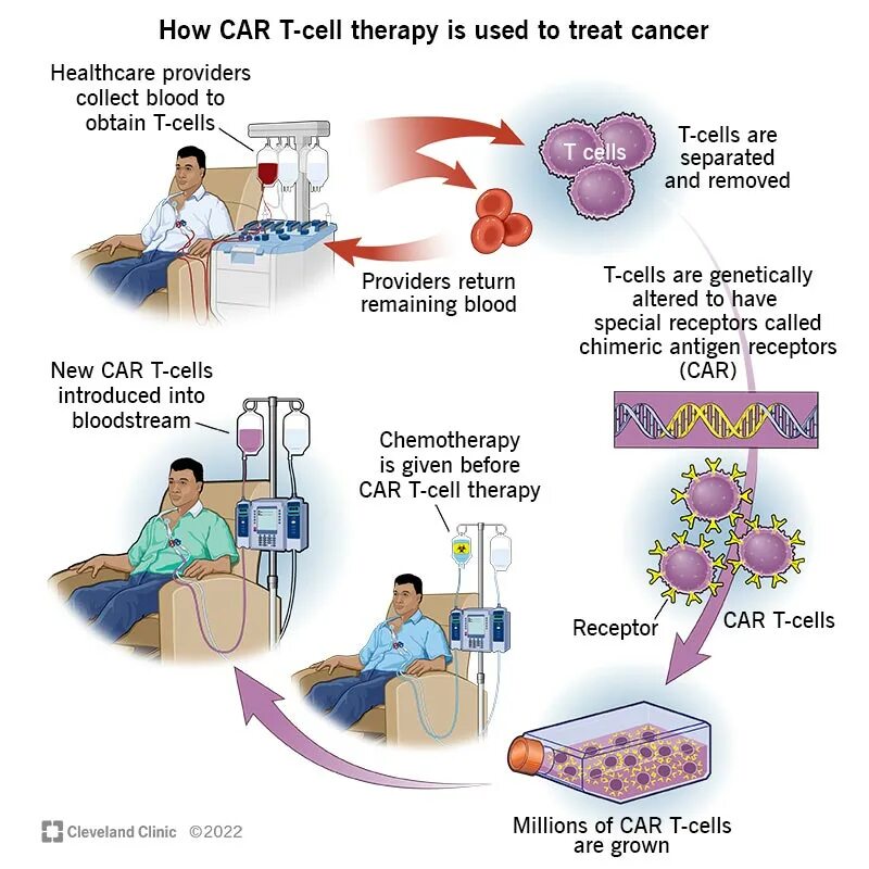 Car t therapy. Cart терапия. Т-клеточная терапия химерным антигенным рецептором (car). Car t therapy. Cart терапия.