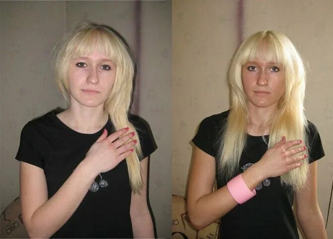 Лицо после солярия. До и после автозагара. автозагар на бледную кожу. кожа до и после солярия. солярий до и после.