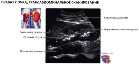 Размеры правой почки