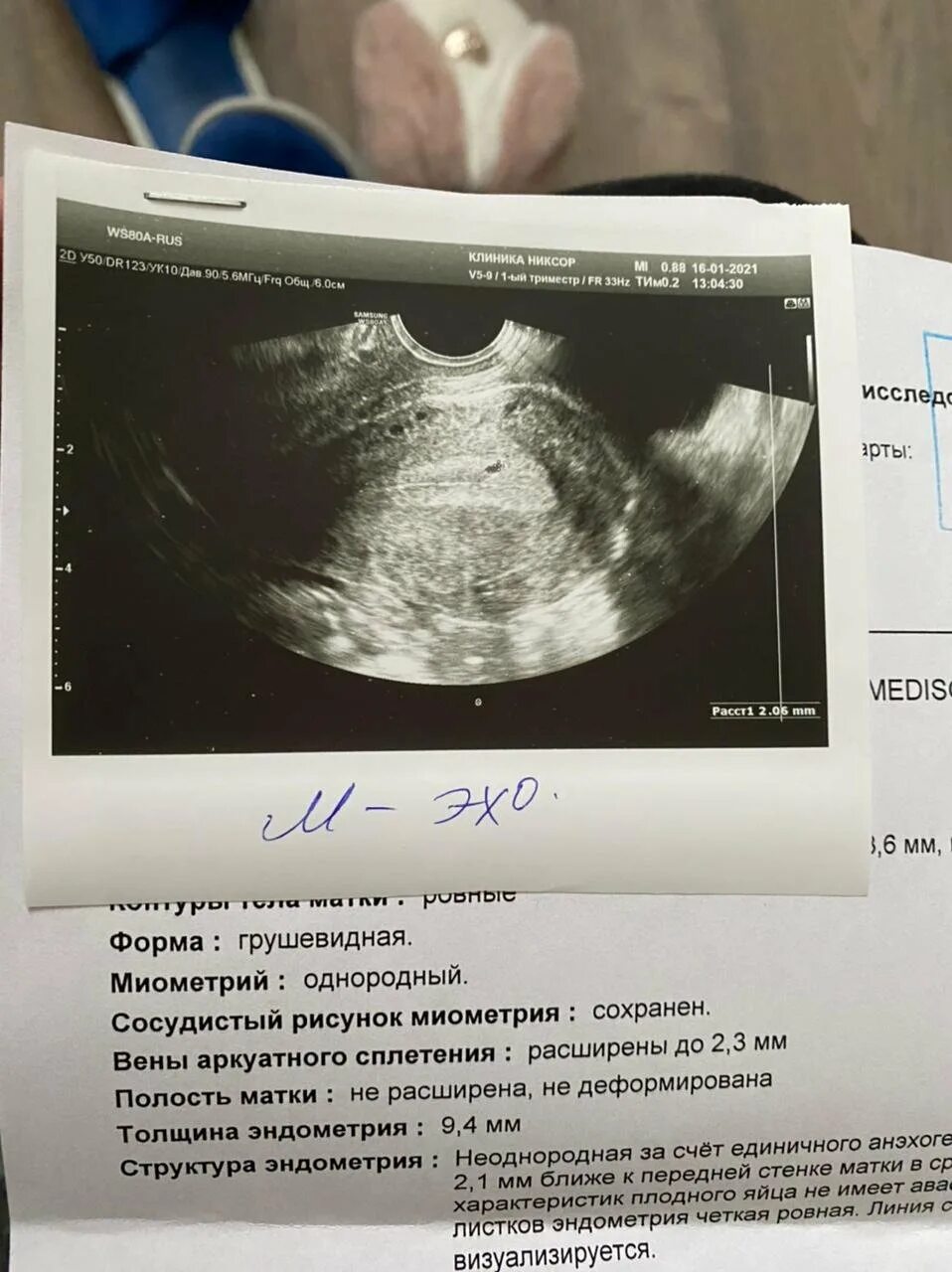 6 мм плодное. Плодное яйцо на УЗИ 3,1 мм.